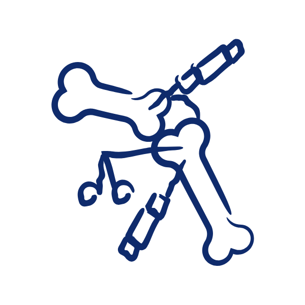 Arthroscopic Surgeries