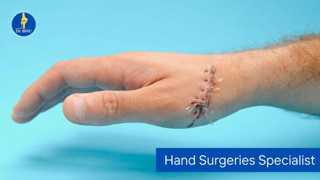 Hand Surgeries