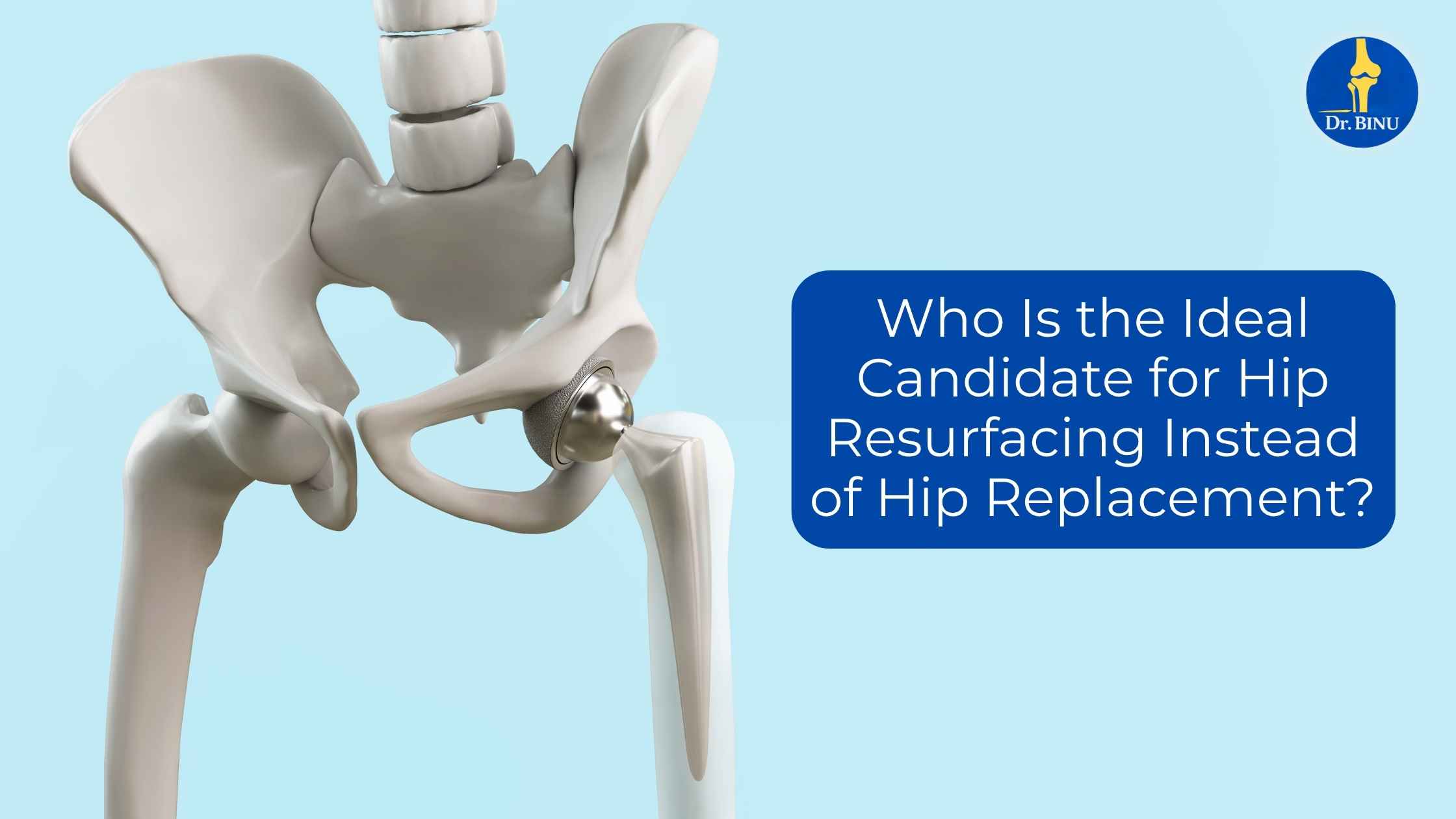 Who is the ideal candidate